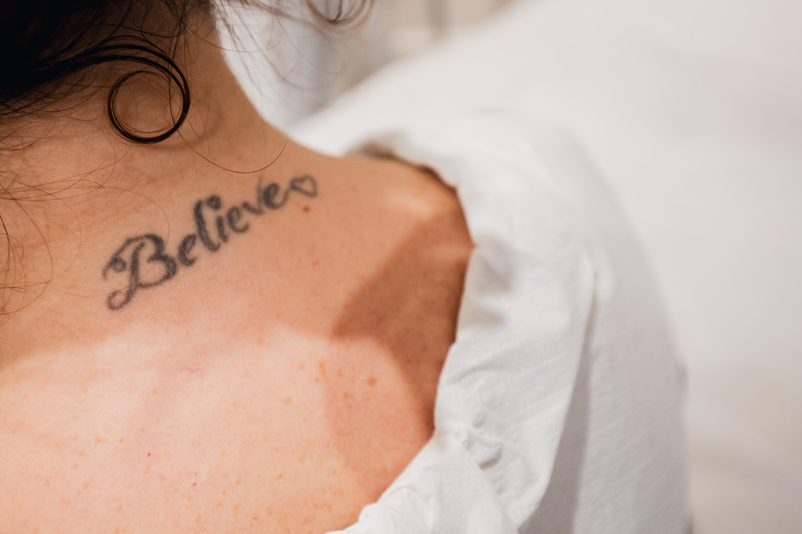 Laser tattoo removal